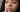 Hormonal Acne and Hyperpigmentation: Understanding, Treating, and Supporting Hormonal Balance Naturally