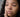 Hormonal Acne and Hyperpigmentation: Understanding, Treating, and Supporting Hormonal Balance Naturally
